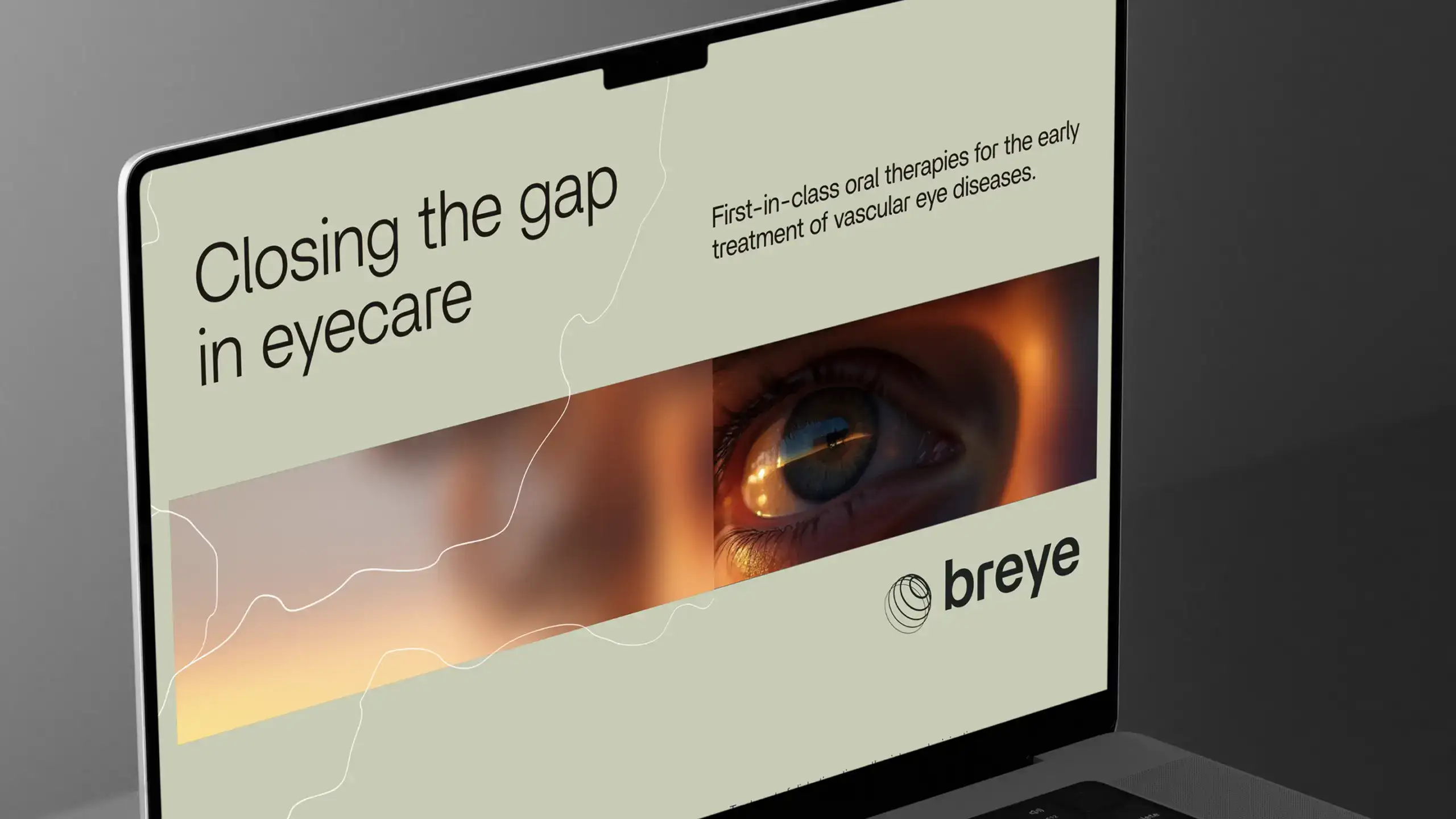 br pitch close front